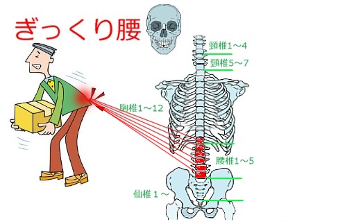 ぎっくり腰