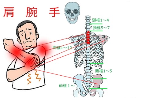 手の痛み