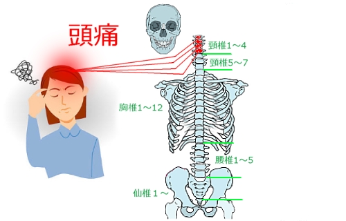 頭痛