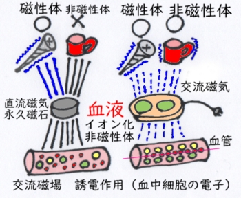 脳血流磁気