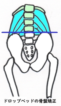 前傾と後傾運動骨盤調整