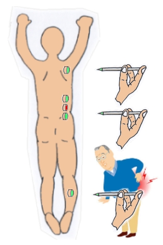 腰痛鍼灸13