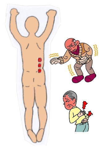 腰痛ツボ・鍼灸16